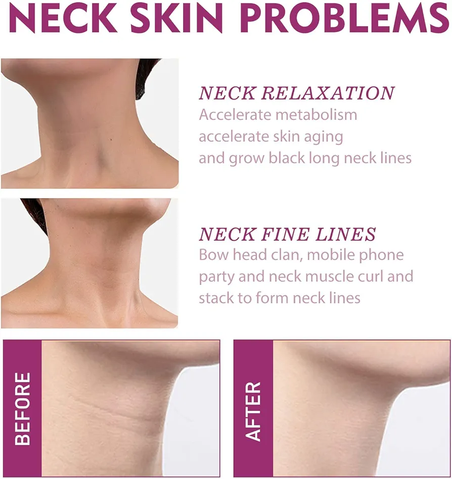 Hydrolyzed Collagen Face and Neck Cream - Image 3