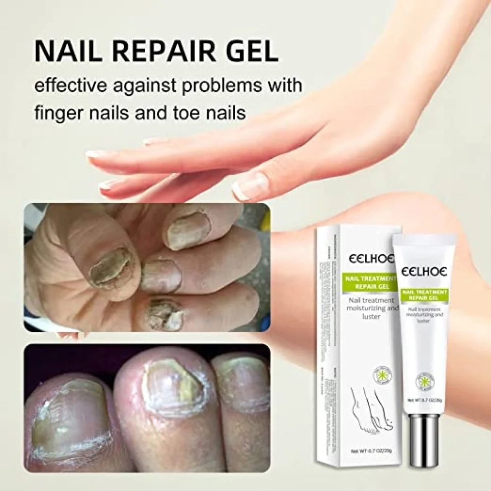 Nail Repair & Fungus Treatment Solution - Image 2