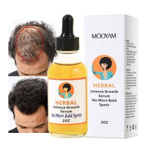 Hair Growth Serum – Anti Hair Fall & Hair Regrowth Serum